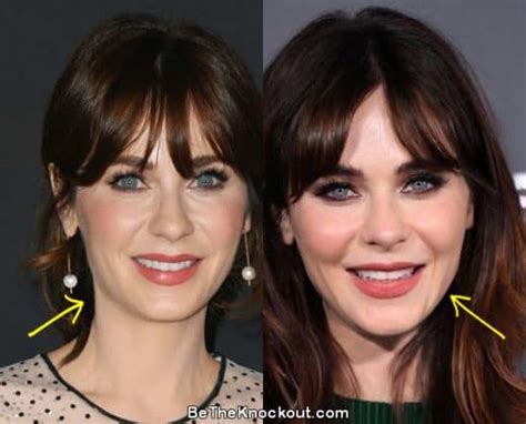 zooey deschanel facelift|Zooey Deschanel Plastic Surgery Before & After